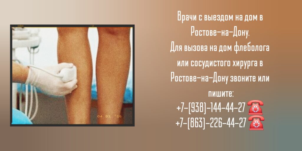 Сосудистый хирург вызов на дом Ростов-на-Дону