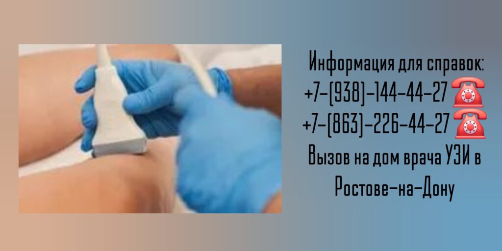 УЗИ вен и сосудов ног на дому - Ростов-на-Дону 
