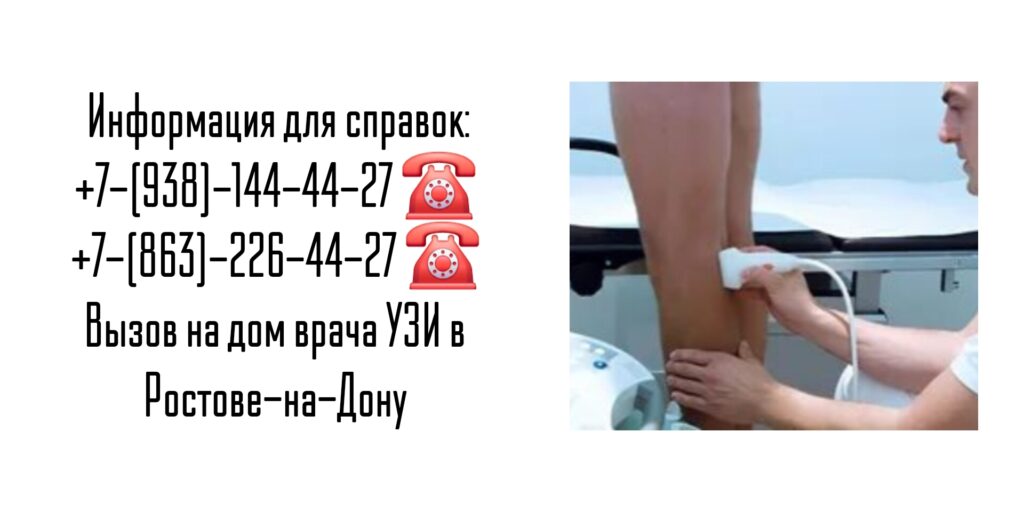 УЗИ вен и сосудов ног на дому - Ростов-на-Дону 