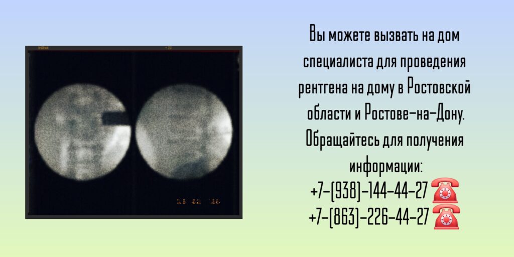 Ростовская область и Ростов-на-Дону - Рентген на дому
