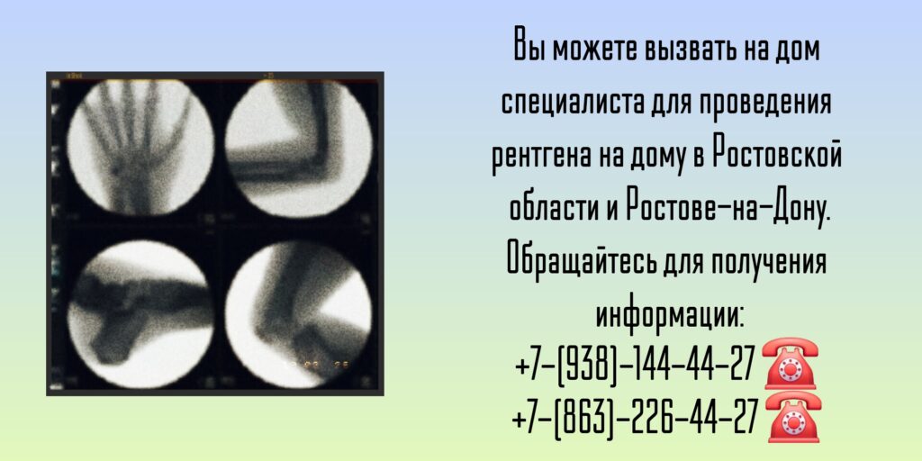 Ростовская область и Ростов-на-Дону - Рентген на дому