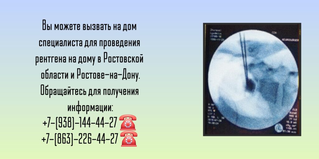 Ростовская область и Ростов-на-Дону - Рентген на дому