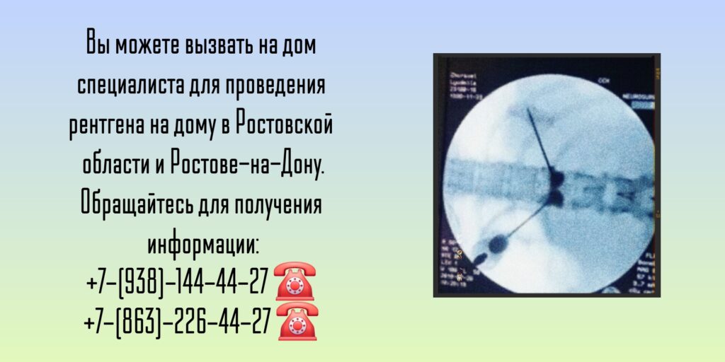 Ростовская область и Ростов-на-Дону - Рентген на дому