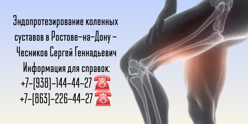 Ростов операции на коленных суставах - Чесников Сергей Геннадьевич