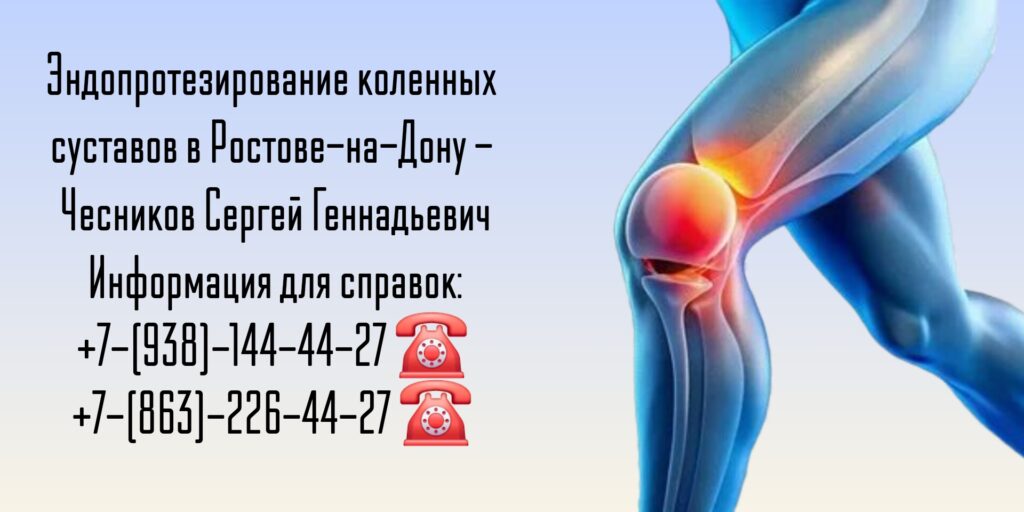 Ростов операции на коленных суставах - Чесников Сергей Геннадьевич