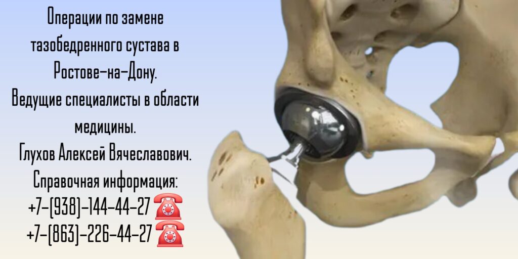 Замена Тазобедренных суставов в Ростове-на-Дону - Глухов Алексей Вячеславович 