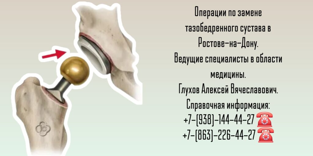 Замена Тазобедренных суставов в Ростове-на-Дону - Глухов Алексей Вячеславович 