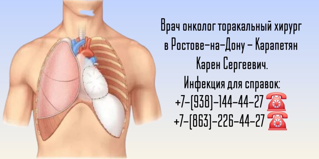 Карапетян Карен Сергеевич- торакальный хирург Ростов