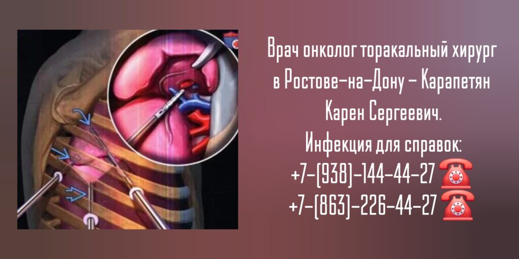Карапетян Карен Сергеевич- торакальный хирург Ростов