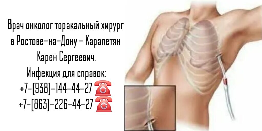 Карапетян Карен Сергеевич- торакальный хирург Ростов