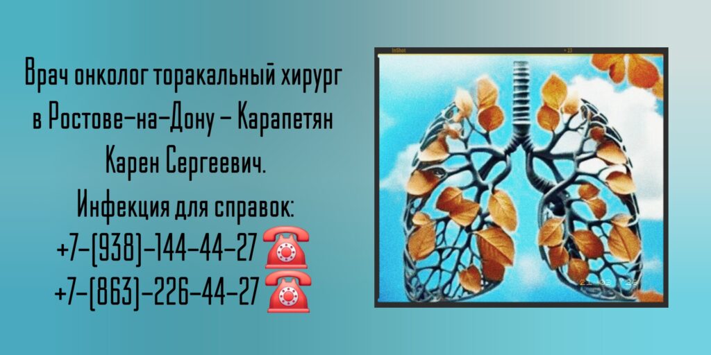 Карапетян Карен Сергеевич- торакальный хирург Ростов