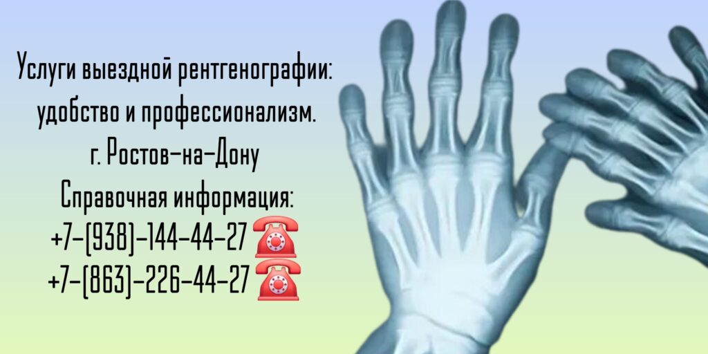 Ростов-на-Дону врач на дом - рентген на дому