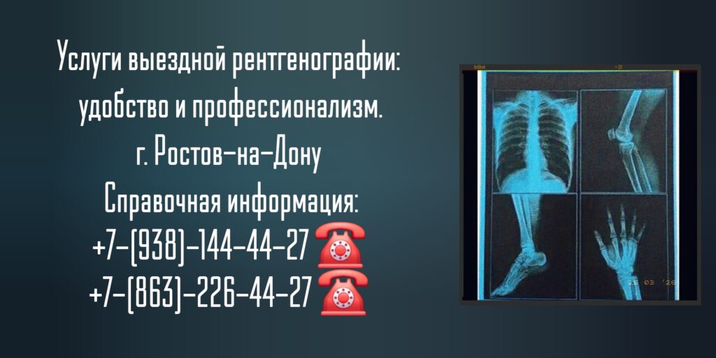 Ростов-на-Дону врач на дом - рентген на дому
