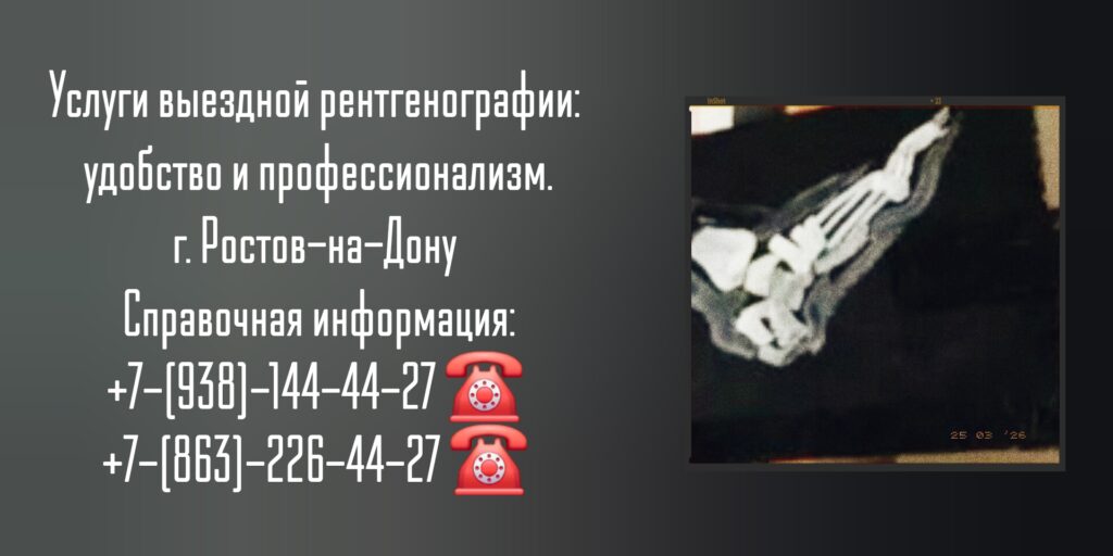 Ростов-на-Дону врач на дом - рентген на дому