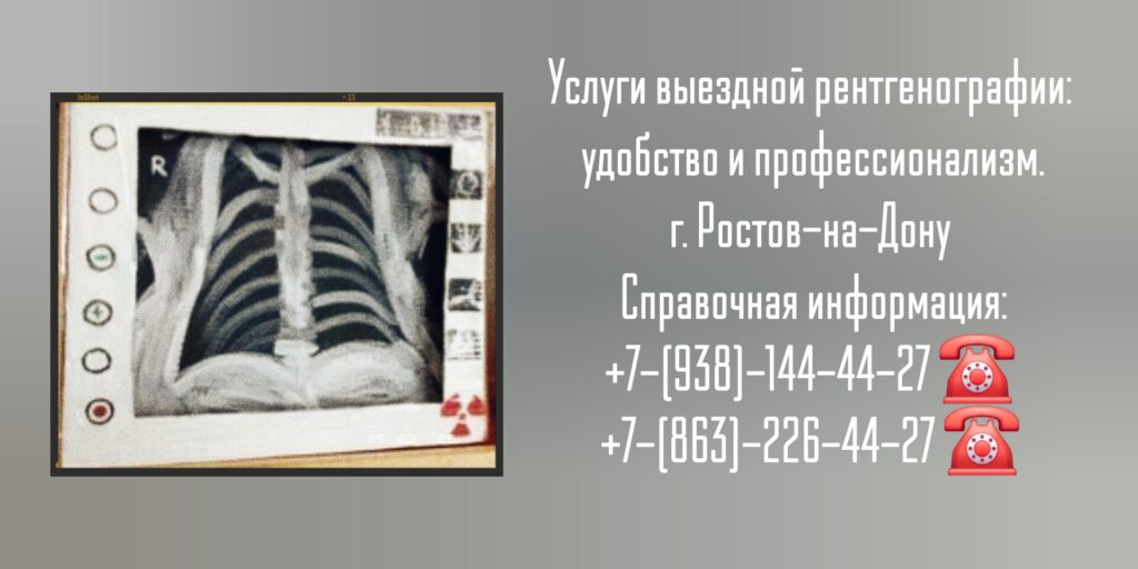 Ростов-на-Дону врач на дом - рентген на дому