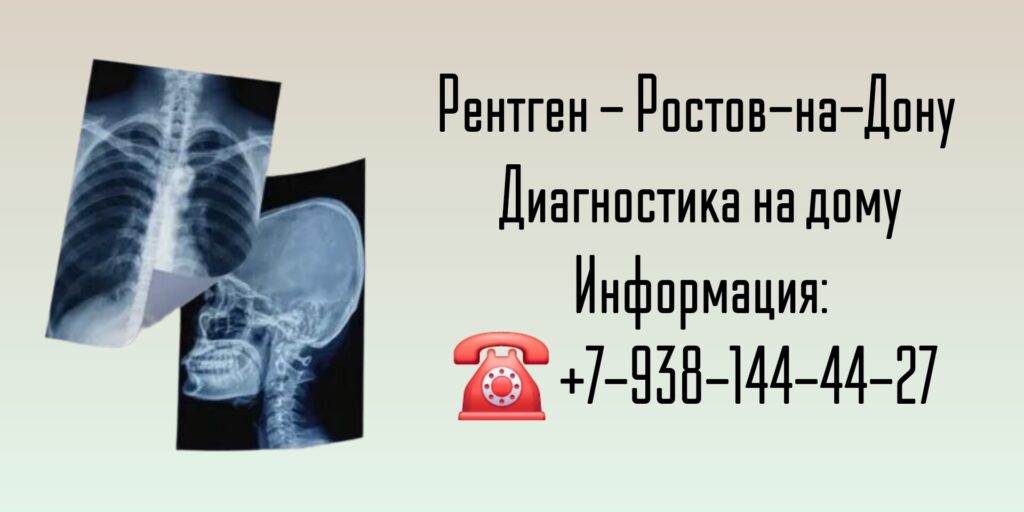 Вызов врача - рентген на дому