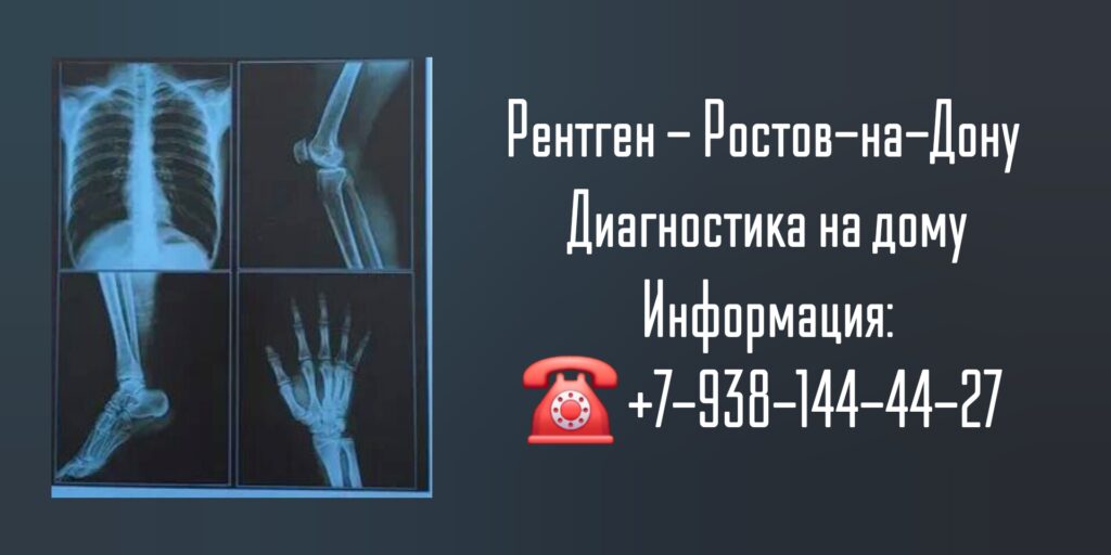 Вызов врача - рентген на дому