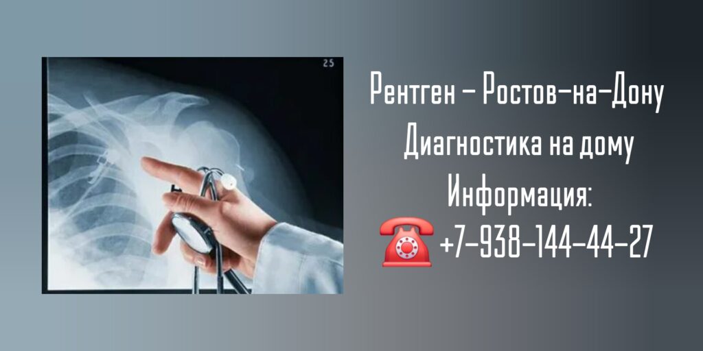 Вызов врача - рентген на дому