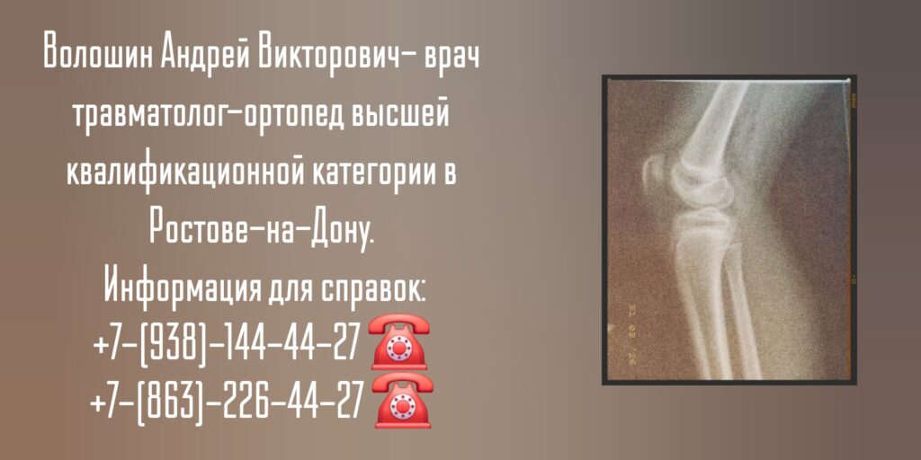 Консультация травматолога - ортопеда в Ростове-на-Дону - Волошин А.В.