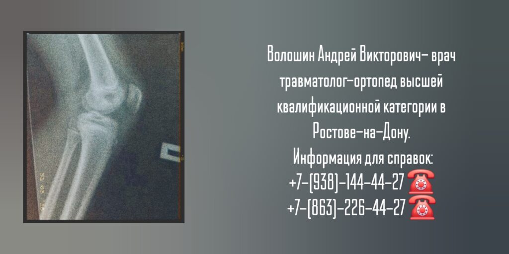 Консультация травматолога - ортопеда в Ростове-на-Дону - Волошин А.В.