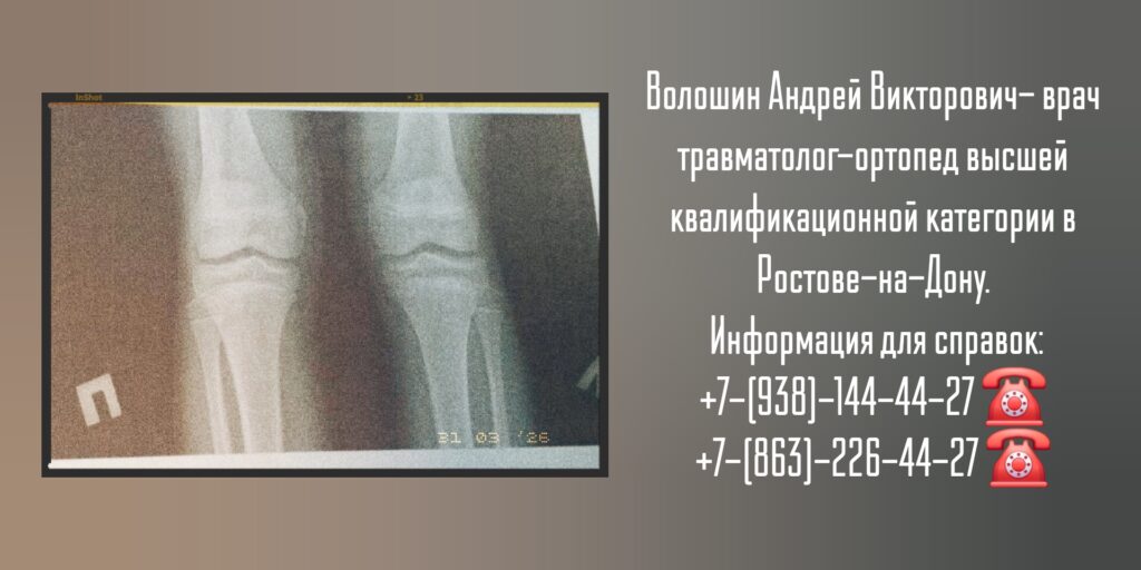 Консультация травматолога - ортопеда в Ростове-на-Дону - Волошин А.В.