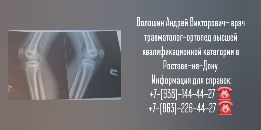Консультация травматолога - ортопеда в Ростове-на-Дону - Волошин А.В.
