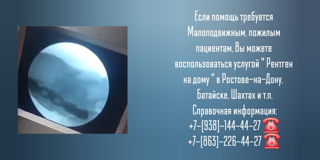Рентген суставов в Ростове-на-Дону- Вызов врача на дом