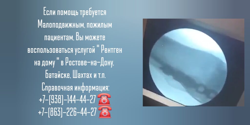 Рентген суставов в Ростове-на-Дону- Вызов врача на дом