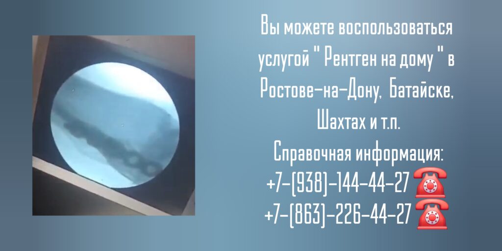 Рентген суставов в Ростове-на-Дону- Вызов врача на дом
