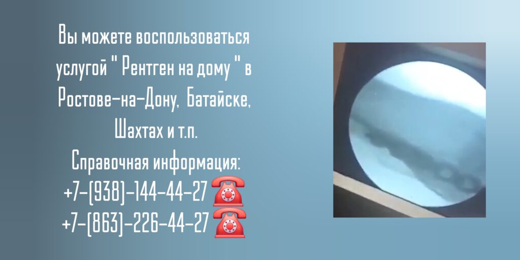 Рентген суставов в Ростове-на-Дону- Вызов врача на дом