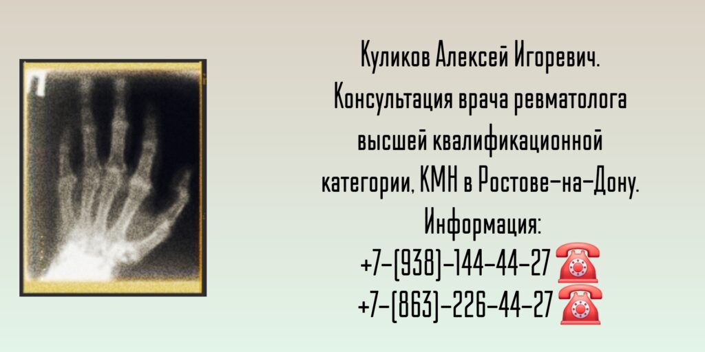 Ростов ревматолог - Алексей Игоревич Куликов