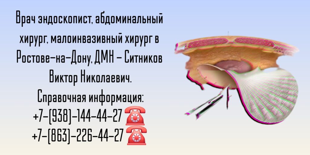Абдоминальный хирург в Ростове-на-Дону- Ситников Виктор Николаевич 