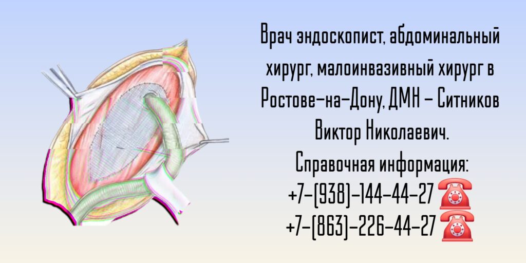 Абдоминальный хирург в Ростове-на-Дону- Ситников Виктор Николаевич 