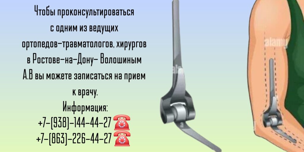 Хирург травматолог Ростов - Волошин Андрей Викторович