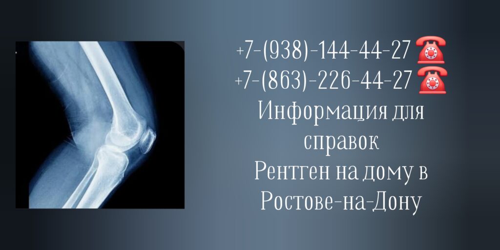 Ростов-на-Дону - Рентген на дому