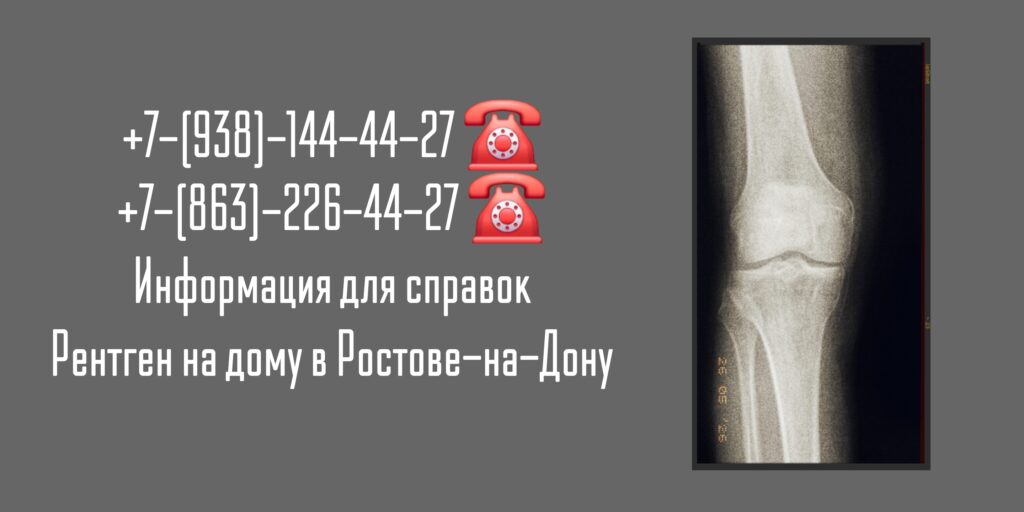 Ростов-на-Дону - Рентген на дому