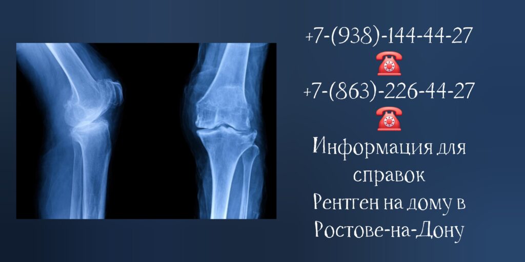 Ростов-на-Дону - Рентген на дому