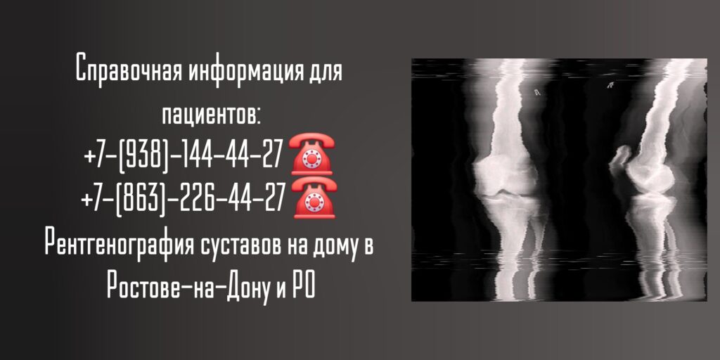 Рентгенография суставов на дому в Ростове-на-Дону 