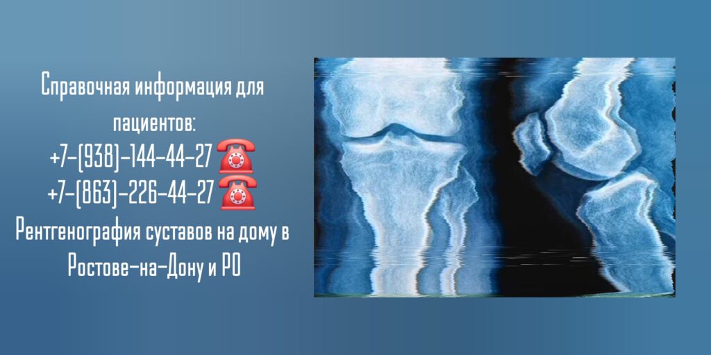 Рентгенография суставов на дому в Ростове-на-Дону 