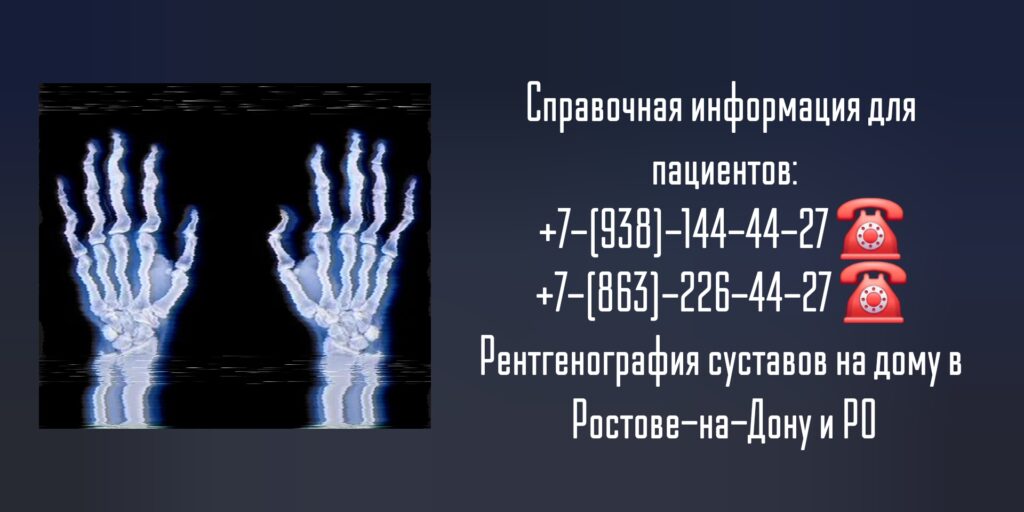 Рентгенография суставов на дому в Ростове-на-Дону 