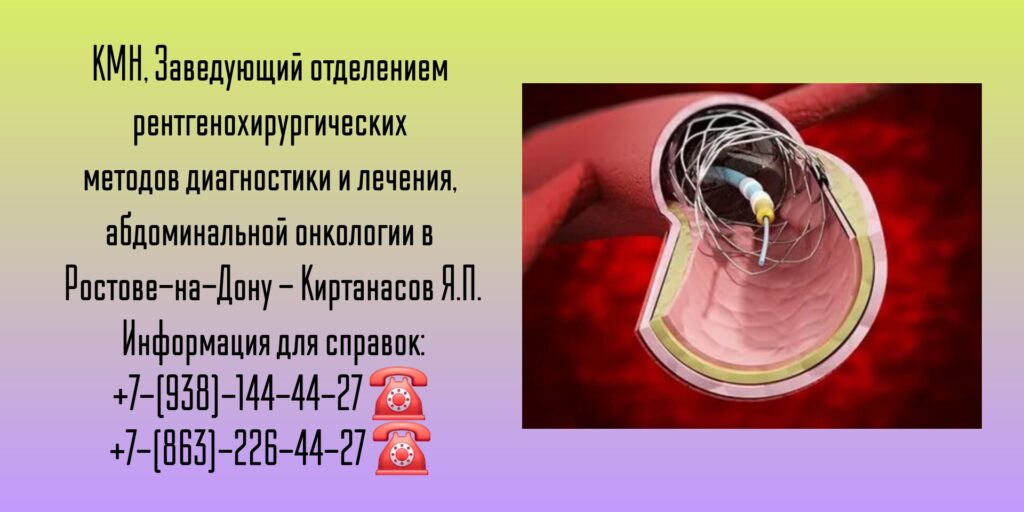 Малоинвазивный хирург Ростов-на-Дону - Киртанасов Яков Павлович