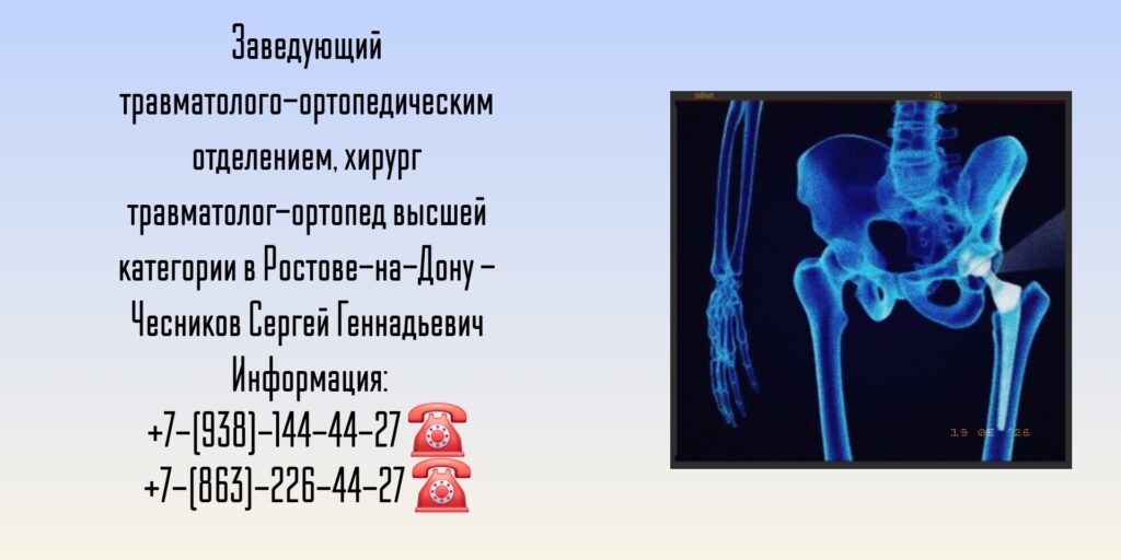 Чесников С Г - врач травматолог-ортопед в Ростове 