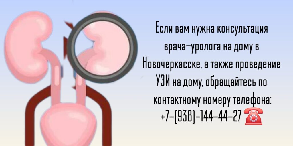 Уролог на дом в Новочеркасске 