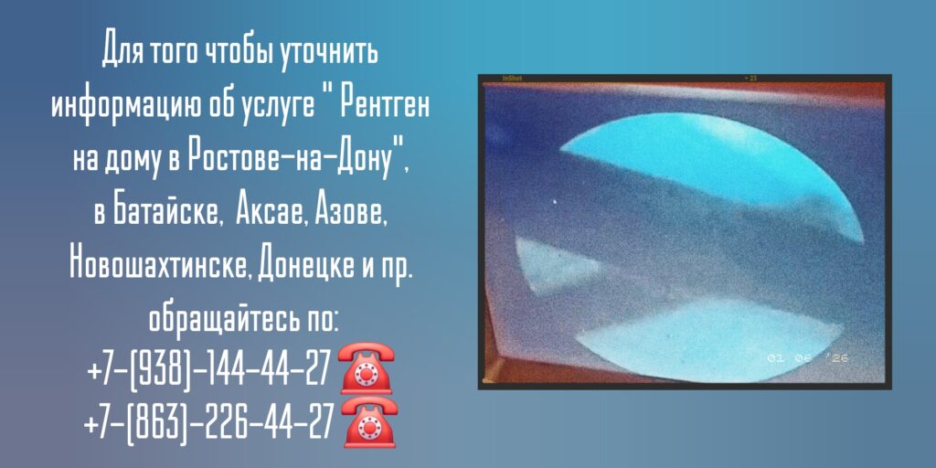 Рентген на дому - Ростов-на-Дону 
