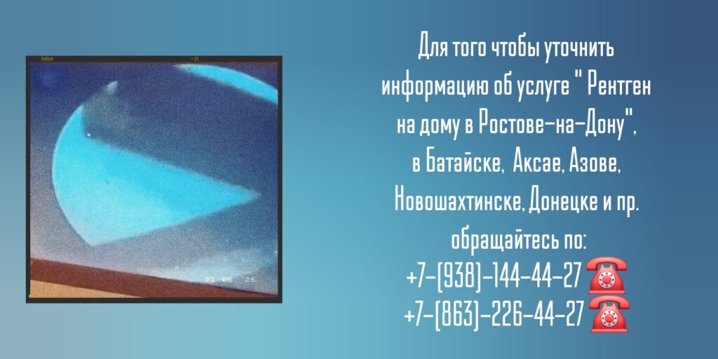 Рентген на дому - Ростов-на-Дону 