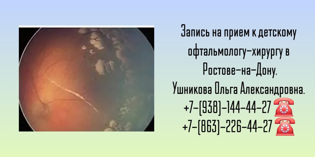 Ретинопатия недоношенных - детский офтальмохирург - Ушникова Ольга Александровна 