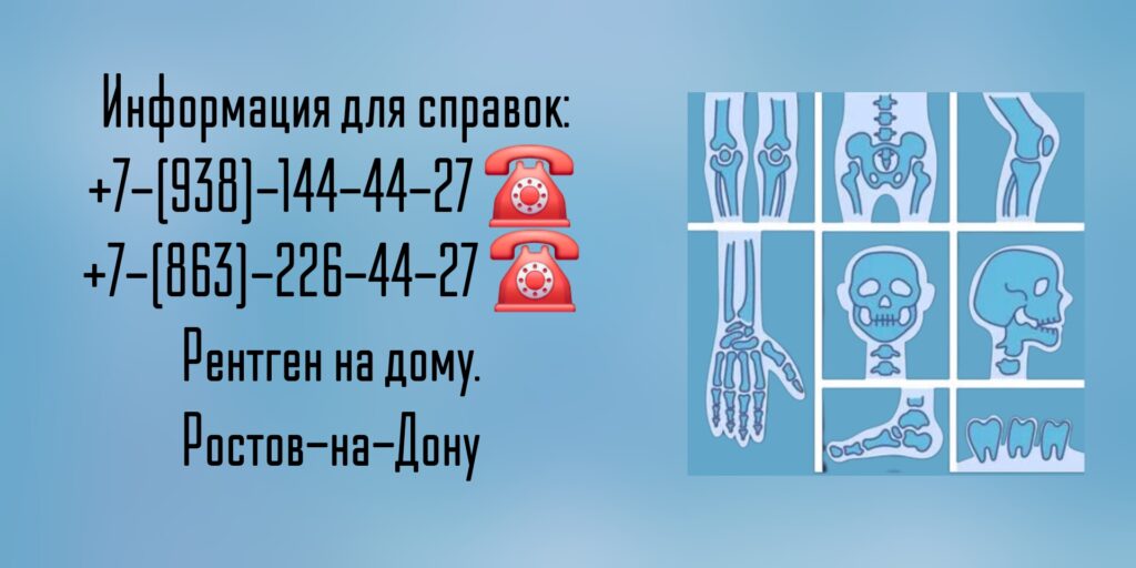 Ростов врач на дом - рентген