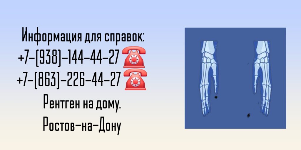 Ростов врач на дом - рентген