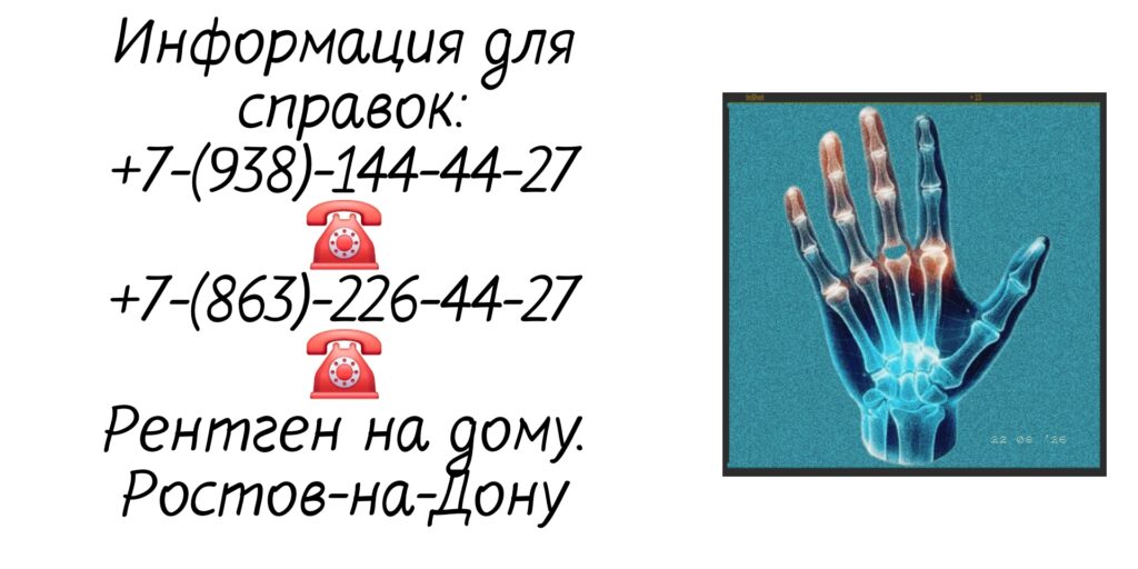 Ростов врач на дом - рентген