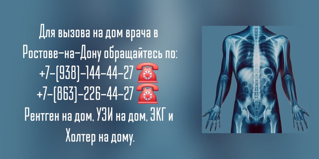 Рентген костей и суставов в Ростове-на-Дону - Вызов на дом
